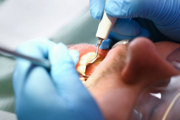 Best Emergency Broken Tooth Repair in West End Cobb Town, AL