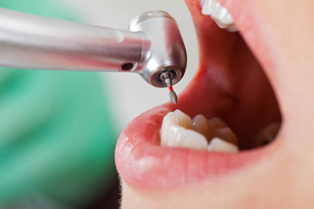 Best After-Hours Emergency Dentist in West End Cobb Town, AL